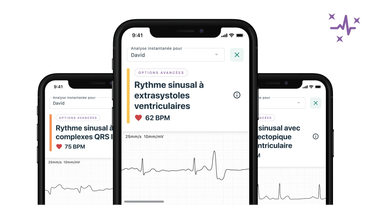 image of mobile devices showing the new Advanced Determinations feature as part of KardiaCare