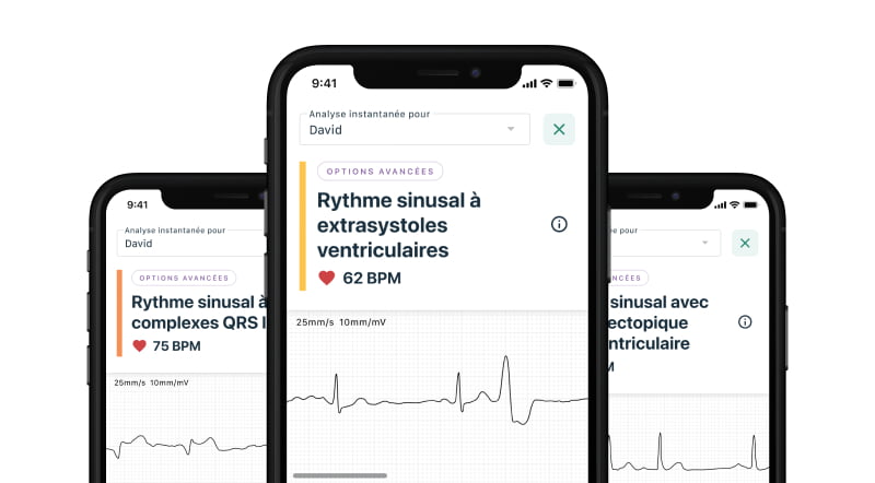 image of mobile devices showing the new Advanced Determinations feature as part of KardiaCare