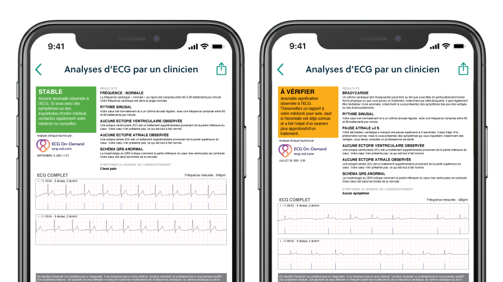 image of 2 phones with overread reports